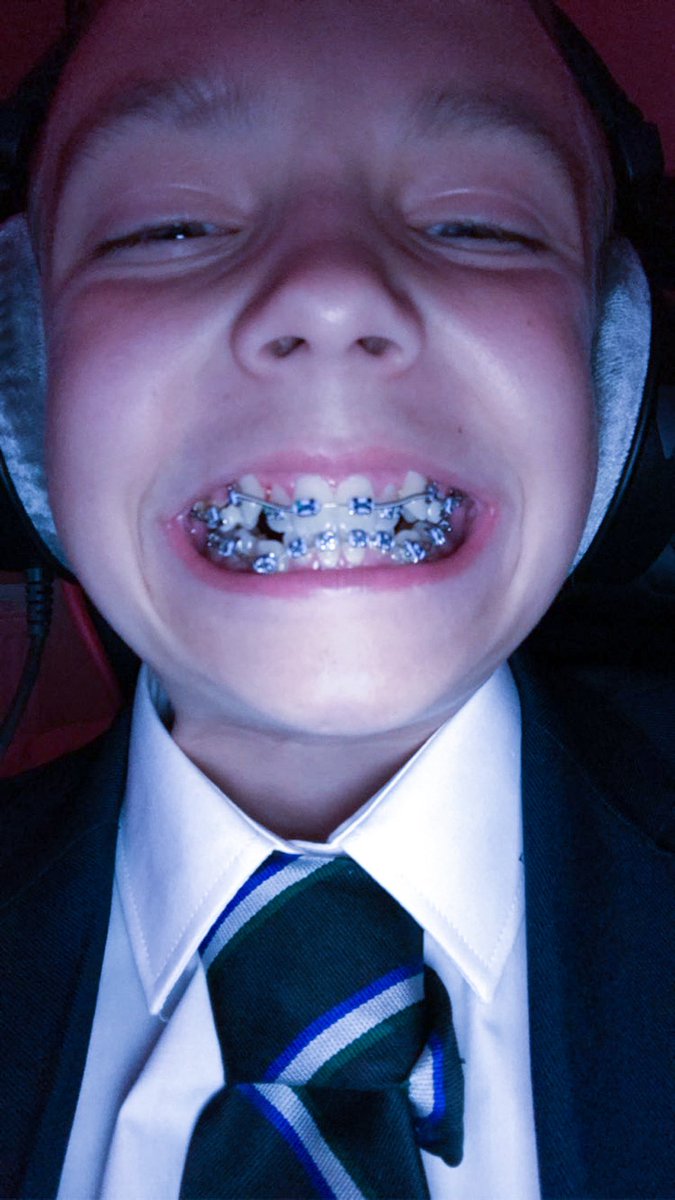 Plickzy on Twitter "Last night having braces, LOOK AT THE