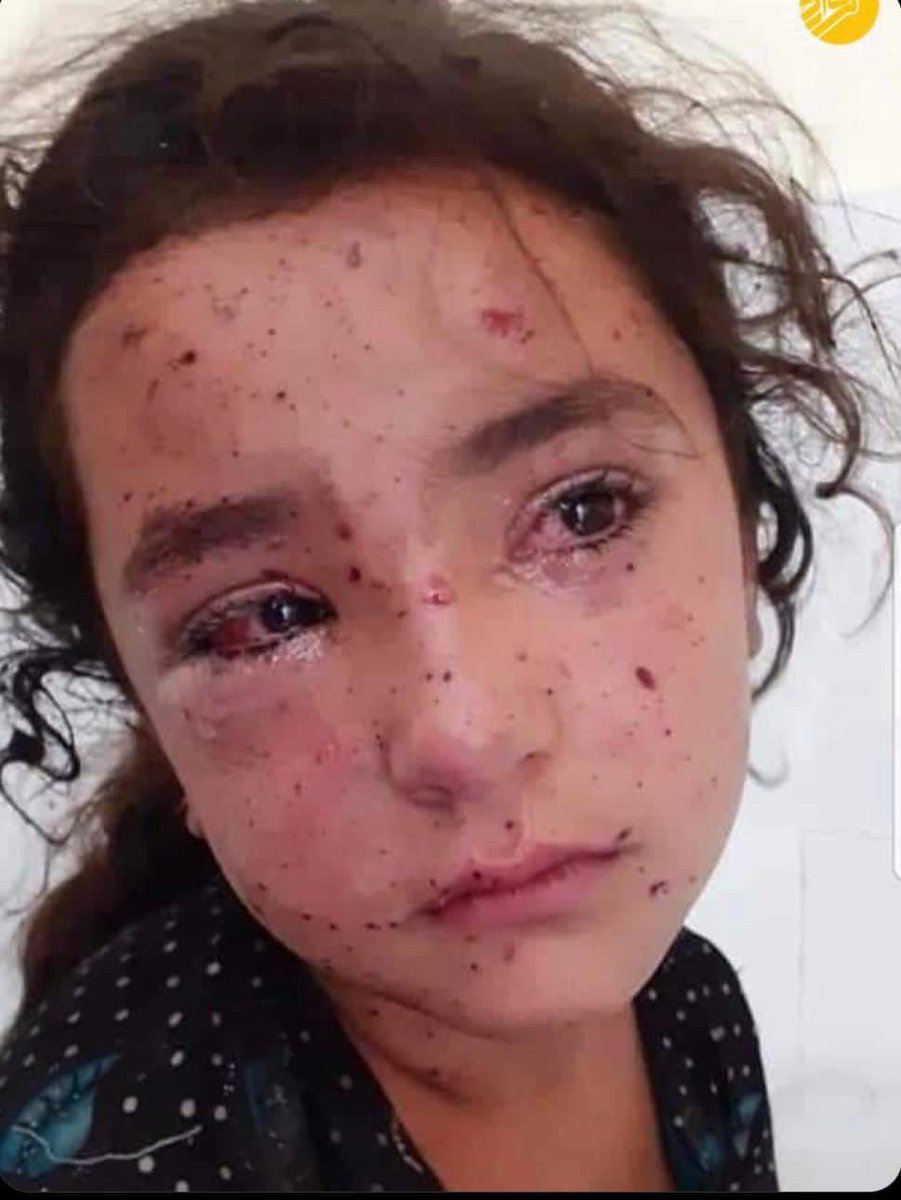 JumaLomani's tweet photo. يك دانه T-shirt كه عكس هاي قربانيان هزاره ها را داشته باشد، و پيام #StopHazaraGenocide هم درآن چاب شده باشد نياز دارم. در تاريخ سوم جانوري ماراتون استوكهلم را با آن خواهم دويد. تقريبا ٢٠ هزار دونده و پنجاه هزار تماشاگر خواهد آمد. يا اگر ايده بهتر داريد، نظر دهيد. https://t.co/jsADMilwW9