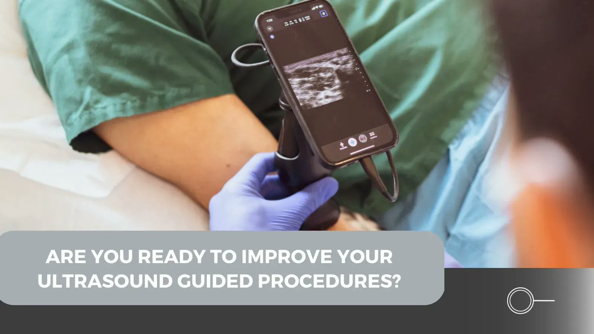 Handheld ultrasound technology is revolutionizing POCUS all over the world, and now when you pair your @butterflynetwork device with OcuLine, your ultrasound guided procedures just got easier! 

#ButterflyiQ #POCUS #oculine #ultrasoundguided #ultrasound #ultrasounddevice