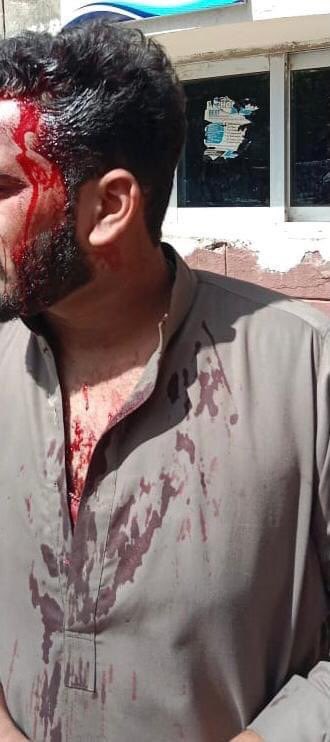 SSC_Of_ARID_Rwp's tweet photo. ایرڈ یونیورسٹی میں سرائیکی طلبہ کے ساتھ مسلسل تعصبانہ رویہ اختیار کیا جا رہا ہے اور ایڈمن DSA کی طرف سے بار بار یونیورسٹی میں موجود غنڈہ گرد گروہوں کو سرائیکیوں کے خلاف لڑائی جھگڑے کی شے دی جا رہی ہے
#ChangeDSA
#Stopstudentharrasment

@1Mahi_ #saveariduniversity https://t.co/3ZDyxSXbHq