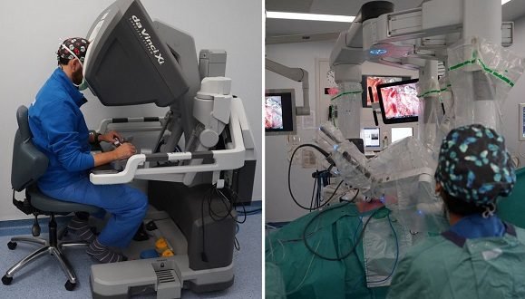 El primer trasplante pulmonar completamente robótico del mundo fue realizado este lunes 17 de abril de 2023 por cirujanos del Hospital Universitario Vall d’Hebron de Barcelona, España