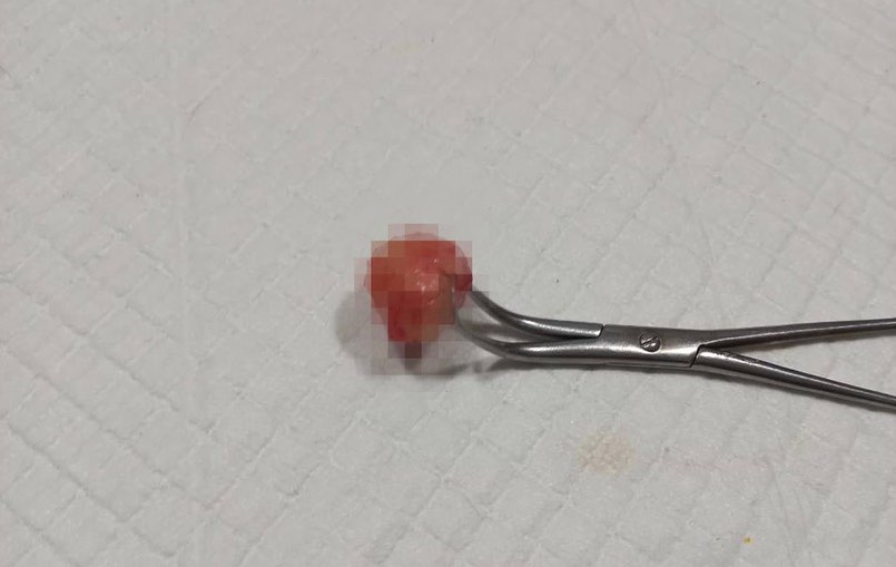 6356axiual96474's tweet image. The first stage of the operation was performed on the lucky cat,
A benign tumor was removed. In a week, an operation is planned in the area of the periosteum, where there is a seal.
🙏🙏🇺🇦🇺🇦🇺🇦😭😭😭🆘🆘🆘🚨🚨
Donate from her treatment 🙏
#UkraineWillWin #Catshelp #Ukraine #helpme