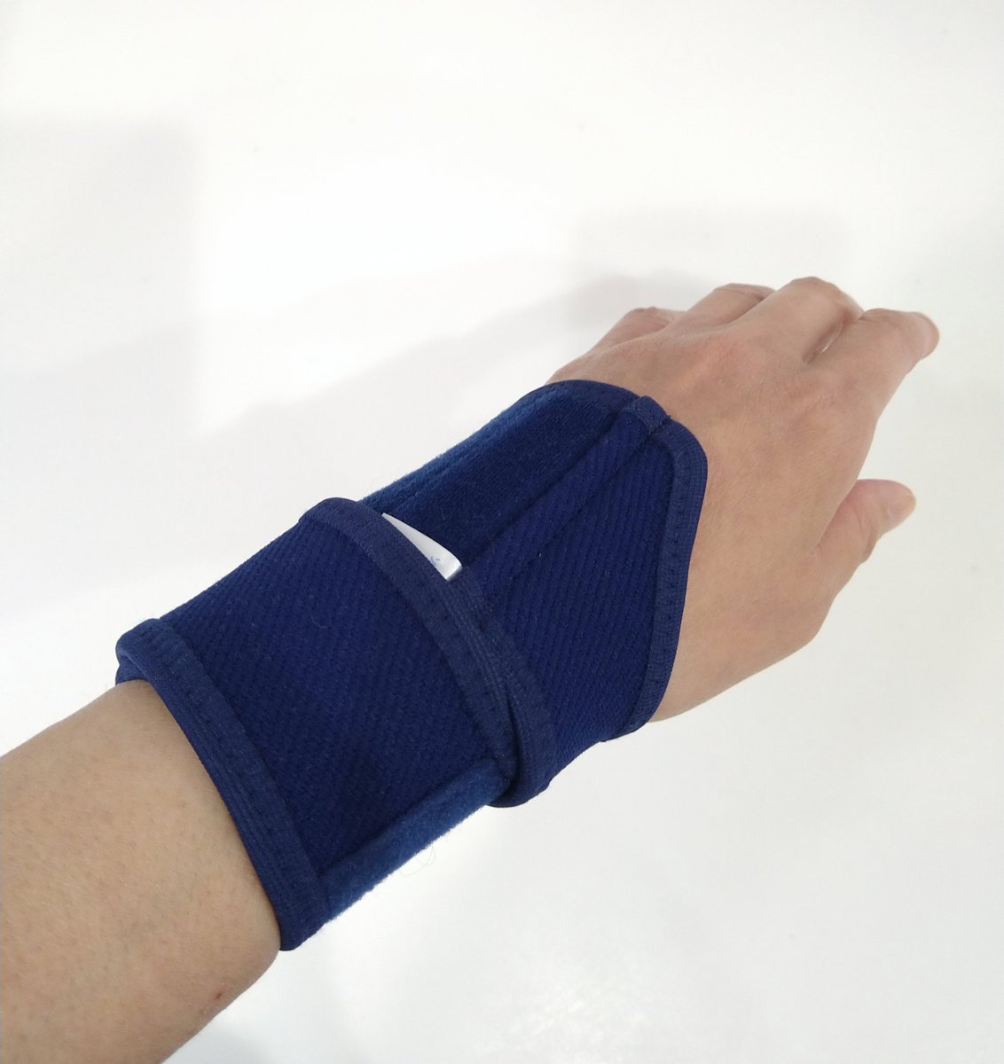 zr400kuma0402's tweet image. 一ヶ月以上前からずっと左手首が痛くて、放っておいても治るかなって思っていたけど、ここ最近痛みが酷いので、外科へ行ってきた。。🏥
TFCC（三角線維軟骨複合体）損傷だって‥🥺

#TFCC
#三角線維軟骨複合体
#サポーター