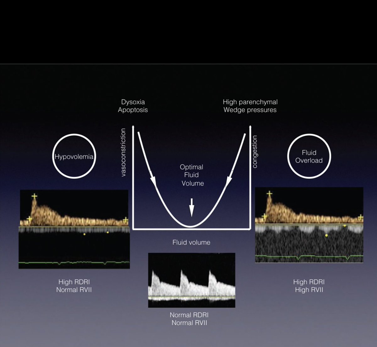 UCARE_group's tweet photo. Renal Doppler-Based Assessment of Regional Organ Perfusion... : Shock https://t.co/sHLwZc0Gx2 https://t.co/jSAO1IXqtm
