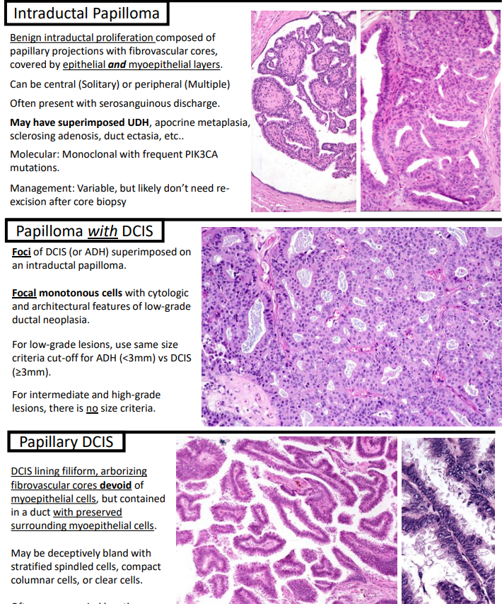 Janiranavarro's tweet photo. The web page I open every time I have a difficult papillary breast lesion.
Thanks Dr. Kurt! You don't know the impact you have in our life as a resident and fellow @KurtSchaberg #comparativepathology #breastpath #pathology #PathTwitter #pathfellow https://t.co/YQvJLkjBU6