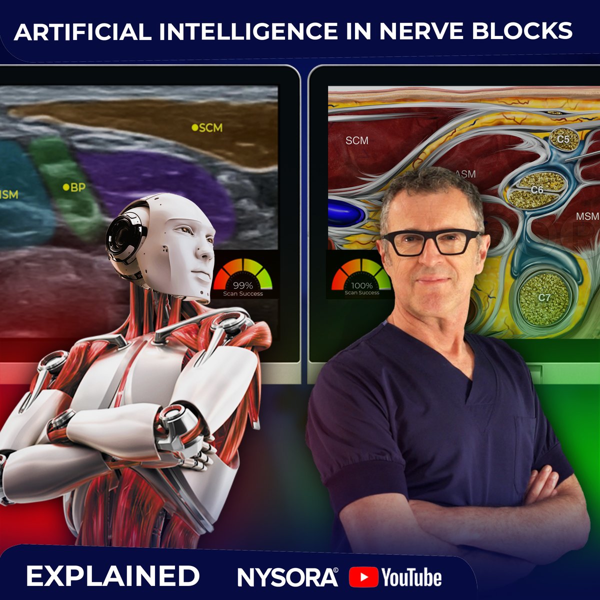 🤖 NYSORA's latest YouTube video talks about the impressive trajectory of AI in #regionalanesthesia and #pocus. Are you curious to see what's next in the world of #medicalAI? 

Watch our new video here: youtube.com/@nysoravideo