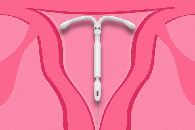 majuzitelli's tweet photo. Você usa ou tem intenção de usar DIU hormonal? Sabe como ele funciona e como ele previne gravidez? Segue o fio que vamos conversar sobre isso 🧶 https://t.co/rHBSlTPq8m