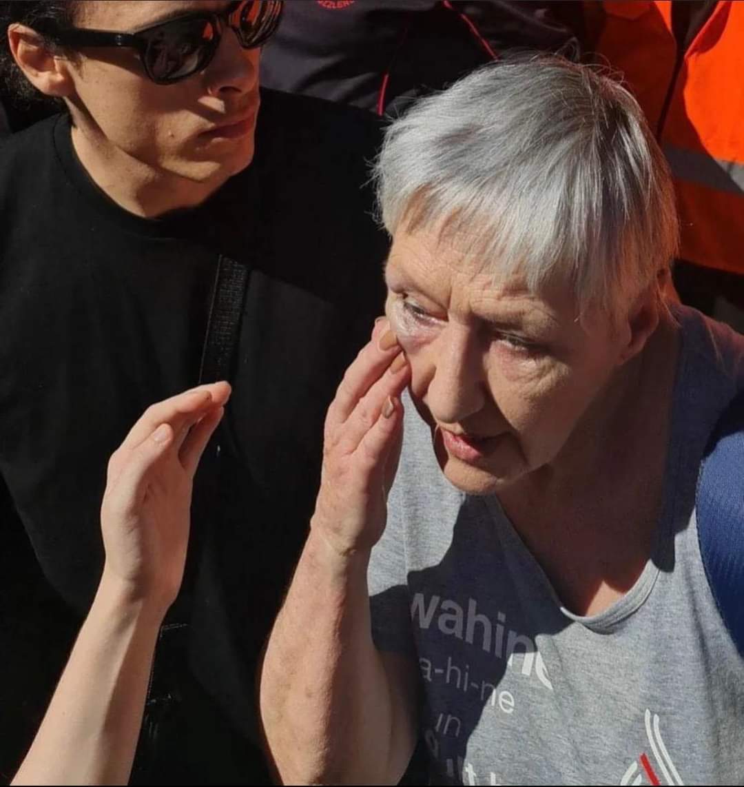Phillyb60192622's tweet photo. Please just retweet, we need to find this dirtbag, bashed an elderly lady at posie-parker rally FIND HIM https://t.co/GMTSZAlozn