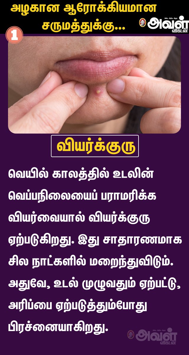AvalVikatan's tweet photo. அழகான ஆரோக்கியமான சருமத்துக்கு...
#Beauty #Beautytips #Skin #Pimples #Health #SkinTips #PimplesTips #Sweating https://t.co/i22x6X8EeH