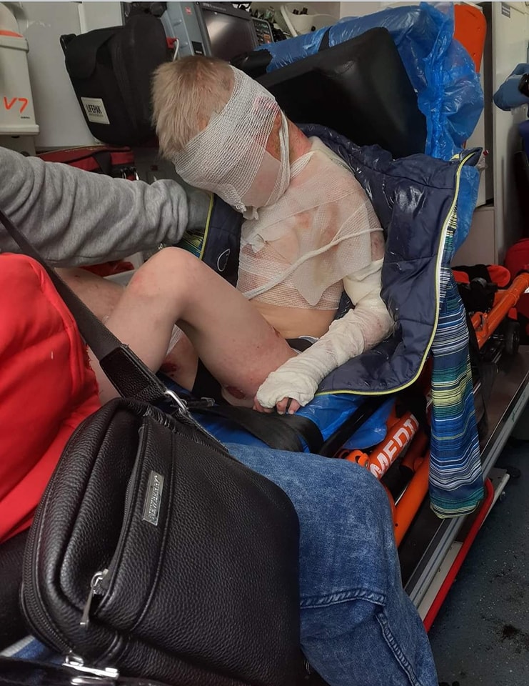 damian_zurawski's tweet photo. Kochani, dostaje od Was setki wiadomości ws. dramatu 8-letniego Kamila z Częstochowy, który przeżył prawdziwe piekło zgotowane przez swoich rodziców i teraz walczy o życie.
Czekam tylko na dobre wieści ze szpitala, że stan chłopca się ustabilizował i odpowiedź od siostry chłopca, która wyrazi zgodę na zorganizowanie przeze mnie zbiórki pieniędzy na jego leczenie.

Wiem, że wielu z Was śledzi tę historię i wiem, że kolejny raz się zjednoczymy i pomożemy!

Edit: Zbiórki które zostały już założone, nie są zweryfikowane!
Bardzo proszę o rozwagę! UDOSTĘPNIJCIE!