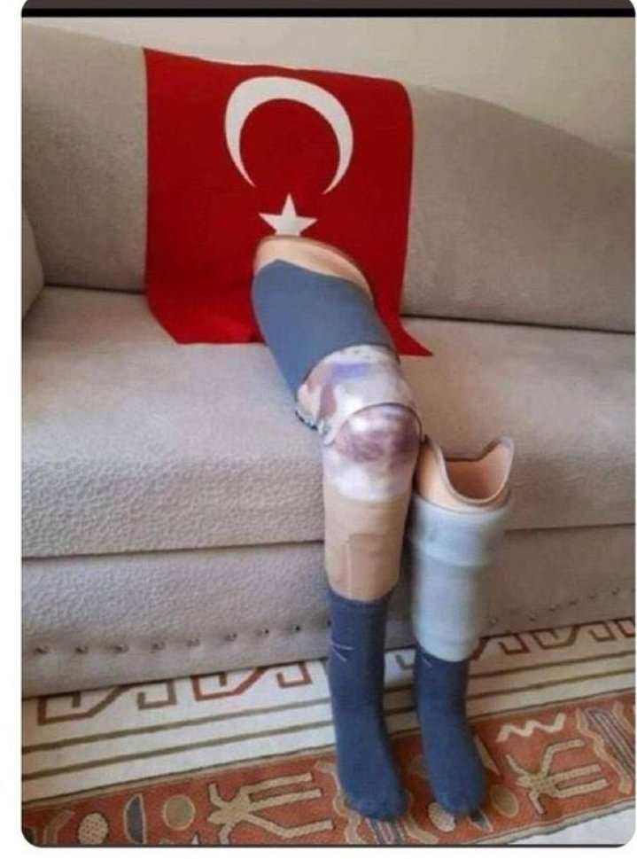Siz hiç Uzman Çavuş olmadınız, siz hiç Uzman Çavuşun ne çektiğini, ne yaşadığını bilmediniz. Sırtınızda 50 kilo çantayla hiç yürümediniz, evladınıza aylarca hasret kalmadınız, hiç soğuktan donmadınız hiç kolunuz bacağınız kopmadı..
 
Hala ne bekliyonuz

#UzmanÇavuş

<a href="/alitilkici38/">Ali Tilkici 🇹🇷</a>