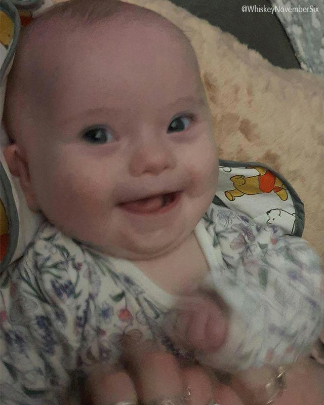 'My 5 month old daughter with Down Syndrome is really discovering her smile now!'

Credit: Reddit: WhiskeyNovemberSix
IG: violetdotty_t21

⭕️ Follow @EpochInspired for more interesting content everyday!
