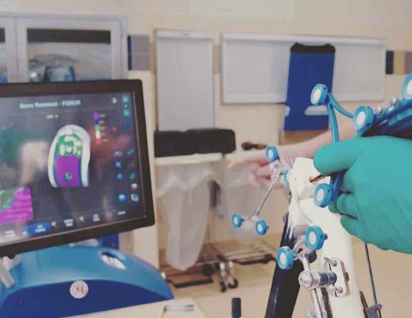 LucaFresta's tweet photo. 🦿La chirurgia protesica robotica monocompartimentale del ginocchio

#robot #ginocchio #knee #protesi https://t.co/ukN4ezI2ep