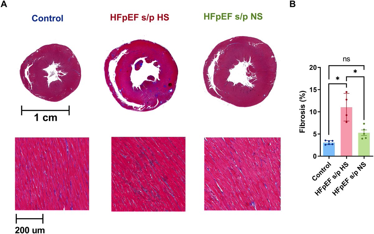 JMCCardiology's tweet photo. From the latest issue of #JMCCPlus, Diet modification reverses diastolic dysfunction in rats with heart failure and preserved ejection fraction 

Open access at https://t.co/ZKzYMAIScC https://t.co/oayhv2wYVO