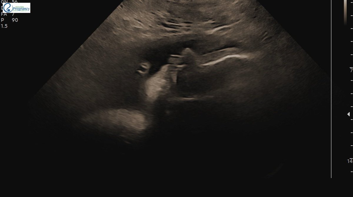 Only a month and 10 days left till baby mark is here!