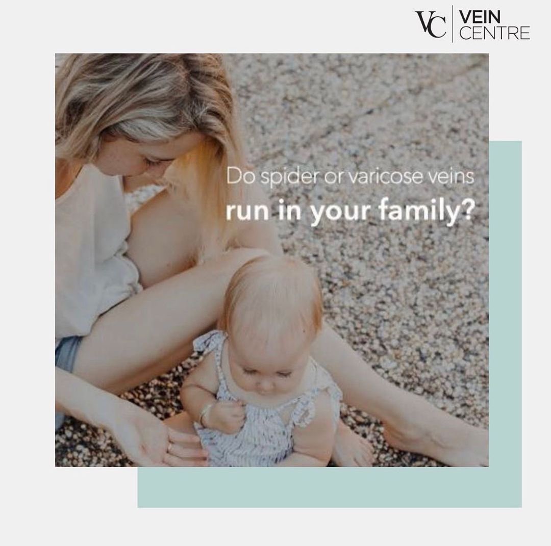 If one parent has #varicoseveins, the risk of having varicose #veins can be as high as 64%. 

If both parents have varicose veins, the risk of developing varicose veins is 90%.

#veinhealth #veintreatment #veintreatmentnashville #nashvilleveintreatment #varicoseveinsnashville