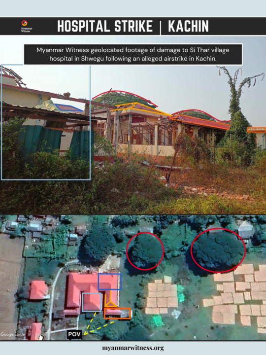 💥Hospital Strike
☑️24.128808, 96.745465
☑️Shwegu, Kachin
5 April 2023

On 5 April 2023, an SAC airstrike allegedly hit Si Thar village hospital in Shwegu, Kachin state, causing considerable damage.

Myanmar Witness has geolocated footage of the damaged hospital.

Source