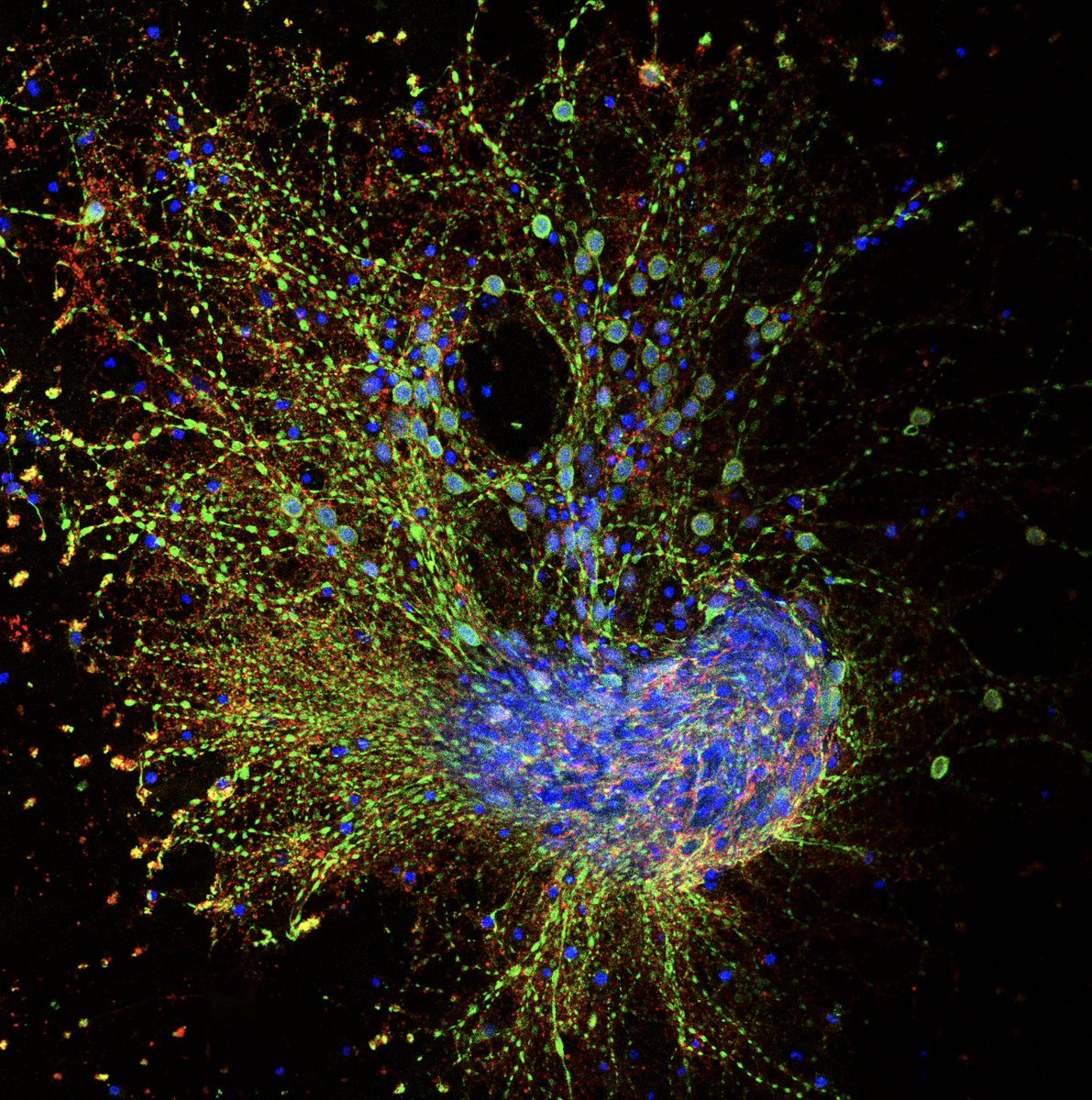 glyconet_nce's tweet photo. Congratulations to Mahsa Taherzadeh for winning the Visual Art and Photography competition! 

Your "Neuronal peacock" image was chosen to be on the cover of the #CGS2023 Book of Abstracts 🔬 https://t.co/D2Afw5zEyH