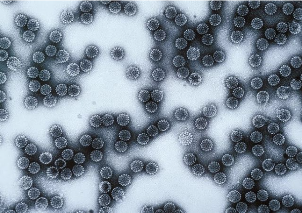Inserm's tweet photo. #HPV Alors que les données scientifiques sur l’efficacité du #vaccin s’accumulent, la couverture vaccinale reste faible en France. #CanalDétox fait le point sur les effets bénéfiques du #vaccin anti-HPV, chez les garçons comme chez les filles.

➡️https://t.co/fBrubdma1f https://t.co/X0ZbSVf34c
