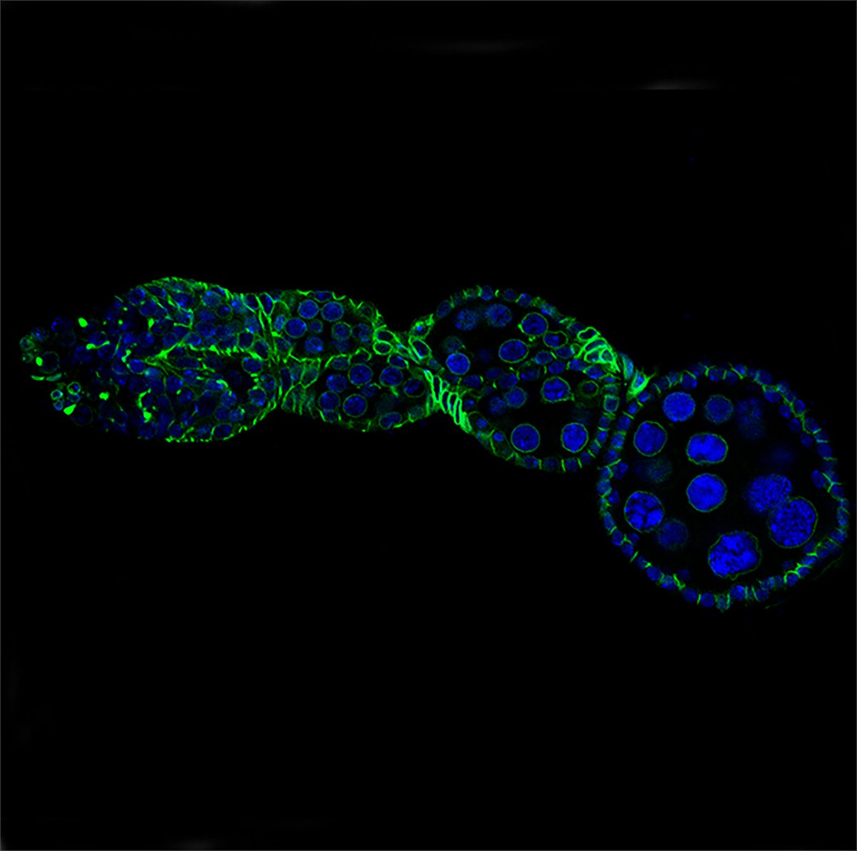 ECLaserTag's tweet image. Congratulations to Lindsay Swain @AblesFlyLab for winning third place in this year's Art of Science image competition! @ECUResearch