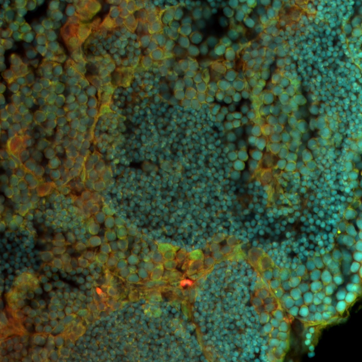 ECLaserTag's tweet image. Congratulations to Jonathan Carver @DidonnaLab for winning an honorable mention in this year's Art of Science image competition! @ECUResearch @ECUBrodySOM @ECU_Biology
