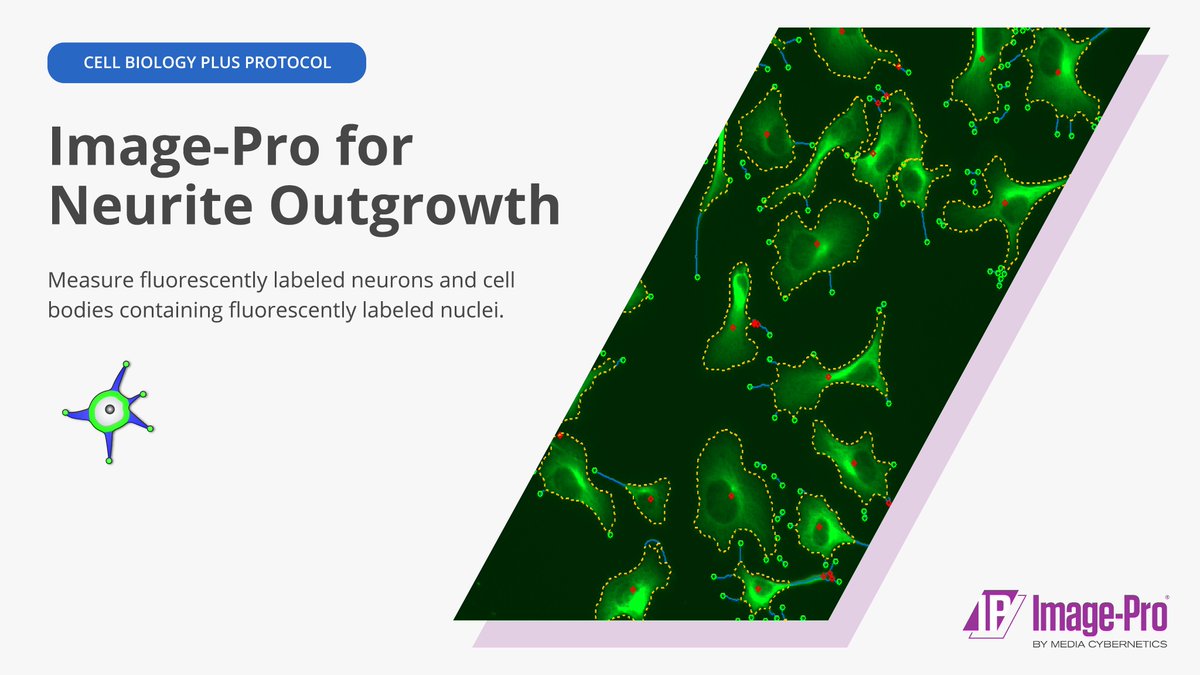 ImageAnalysis's tweet photo. Unravel the mysteries of the brain like never before…🧠
See Image-Pro’s Neurite Outgrowth Analysis Protocol in action:
https://t.co/cuc1lP9UNn
#NeuriteOutgrowth #Neuroscience #CellBiology #ImageAnalysis #MachineLearning #ImagePro #Microscopy #MicroscopyEvolved https://t.co/A84Xs0N1co