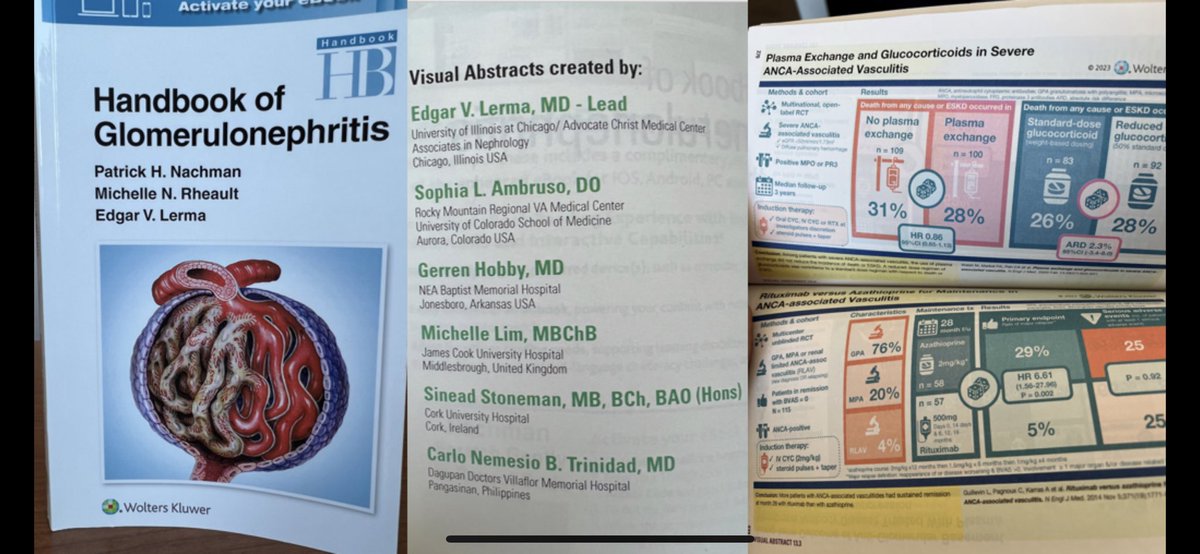 🤩 Complementary #handbookofglomerulonephritis arrived today. Grateful for the opportunity! 🙏🙏

Happy to have this resource at my fingertips as well! 🫰

@edgarvlermamd @rheault_m @ghobby @Stones__ @krishnadoctor1 @whatsthegfr @hellokidneyMD