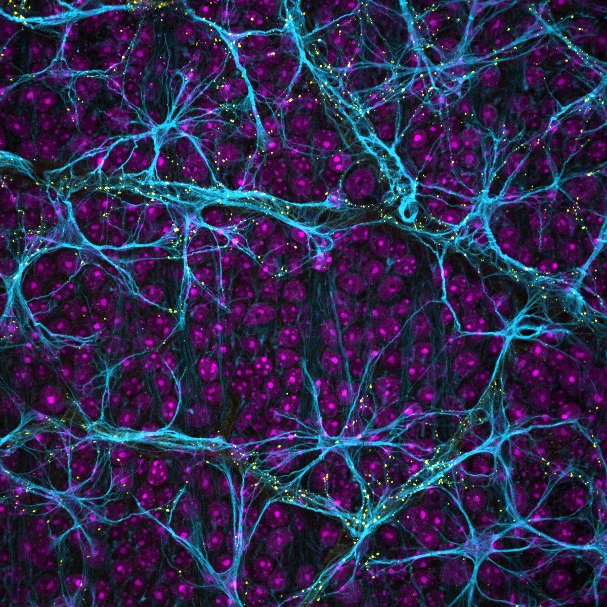 MelCooperPhD's tweet image. I've been obsessing over this image of retinal astrocytes for the past few weeks. Astrocytes (GFAP) in cyan, gap junctions (cx43) in yellow, and DAPI in magenta. Check out their endfeet on the blood vessel in the middle!
@zeiss_micro #neuroscience #Microscopy #womeninscience
