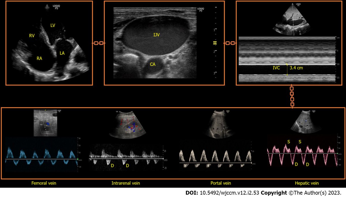 NephroPOCUS tweet media