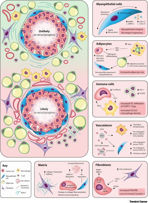 Trends in Cancer (@trendscancer) on Twitter photo From <a href="/drrichardgrose/">Richard Grose</a> and co - how does the microenvironment contribute to progression from #DCIS to invasive ductal carcinoma #breastcancer cell.com/trends/cancer/… From <a href="/drrichardgrose/">Richard Grose</a> and co - how does the microenvironment contribute to progression from #DCIS to invasive ductal carcinoma #breastcancer cell.com/trends/cancer/…