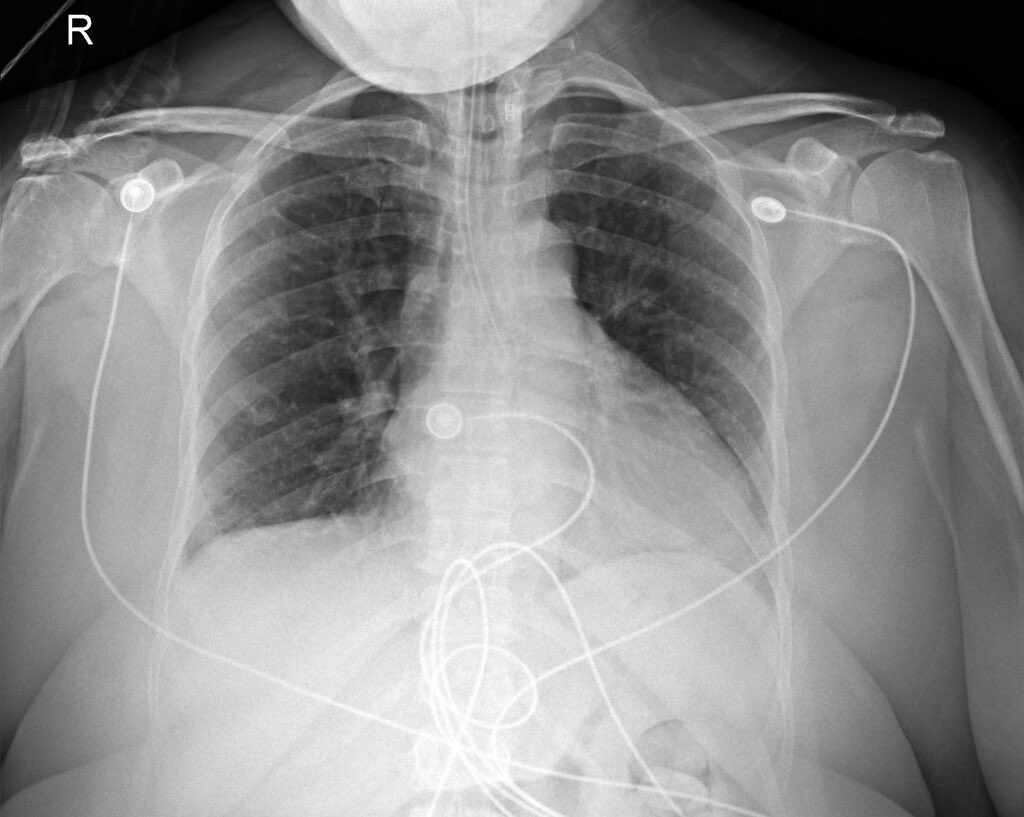 Journal of Brown Hospital Medicine tweet media