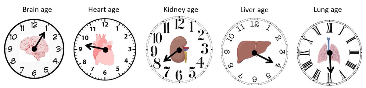 It is time to find out your REAL brain and body age! The age of your brain, heart, lungs etc can be easily measured, differs from your DOB and informs your risk of chronic illness and premature death. Check out our organ age clocks @NatureMedicine rdcu.be/c9kFZ 1/n