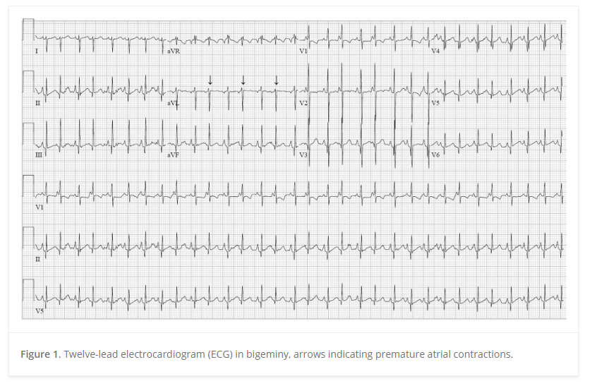 Online first at JCN:
Lacosamide for refractory seizures in the neonatal population - safety, efficacy, and tolerability: journals.sagepub.com/doi/10.1177/08… #nicu #neonatalneurology #pediatricepilepsy