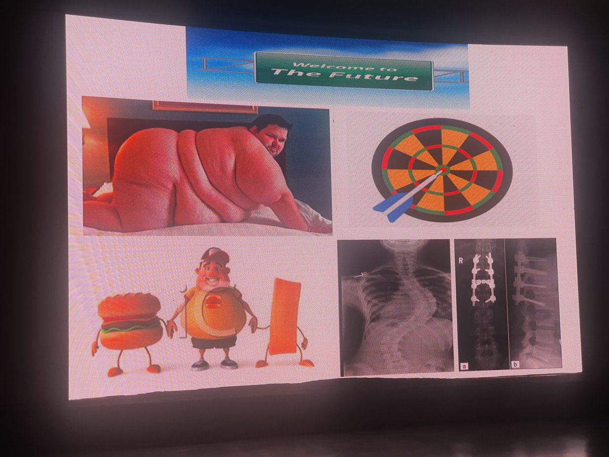 DrDiveshArora's tweet photo. #UGRAVGA
Pocus man @KalagaraHari enlightening the august gathering at Vijaywada India 🇮🇳 on his favorite topic Spine ultrasound..@Nadia_Hdz_MD @KiJinnChin @jeffgadsden @Archana_Areti @vrushali_ponde @anesthetix @drtiger222 @TVSGopal1 @ramkumar_mm @amit_pawa @BalavenkatSubr1 https://t.co/PZM8nY3RUe