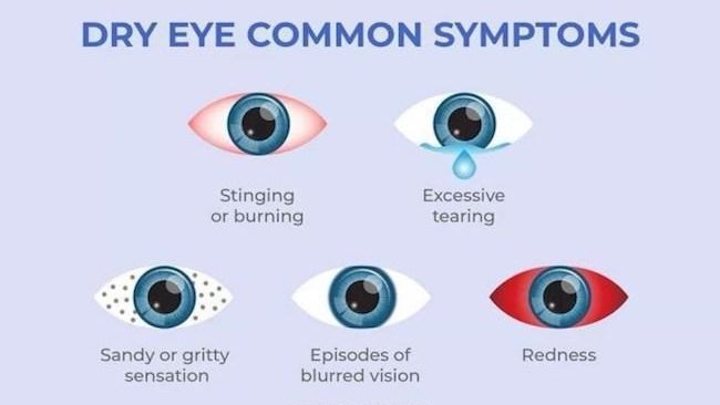 Dry eyes are a part of the natural aging process. The majority of people over age 65 experience some symptoms of dry eyes. Women are more likely to develop dry eyes due to hormonal changes.
#dryeyes #eyehealth #optometry #ophthalmology
