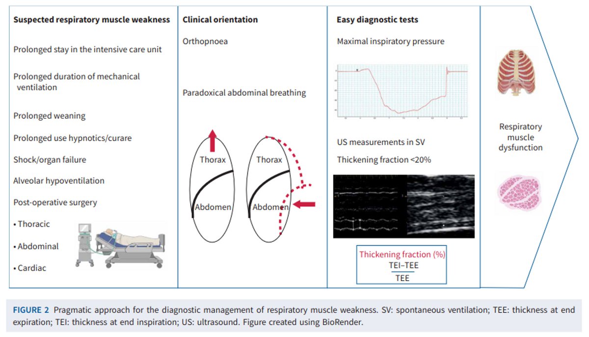 Managing respiratory muscle weakness during weaning from invasive ventilation

CCR Journal Watch
criticalcarereviews.com/latest-evidenc…