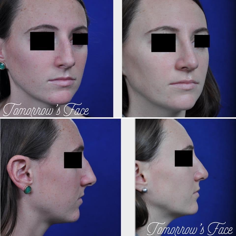 TomorrowsFace tweet media