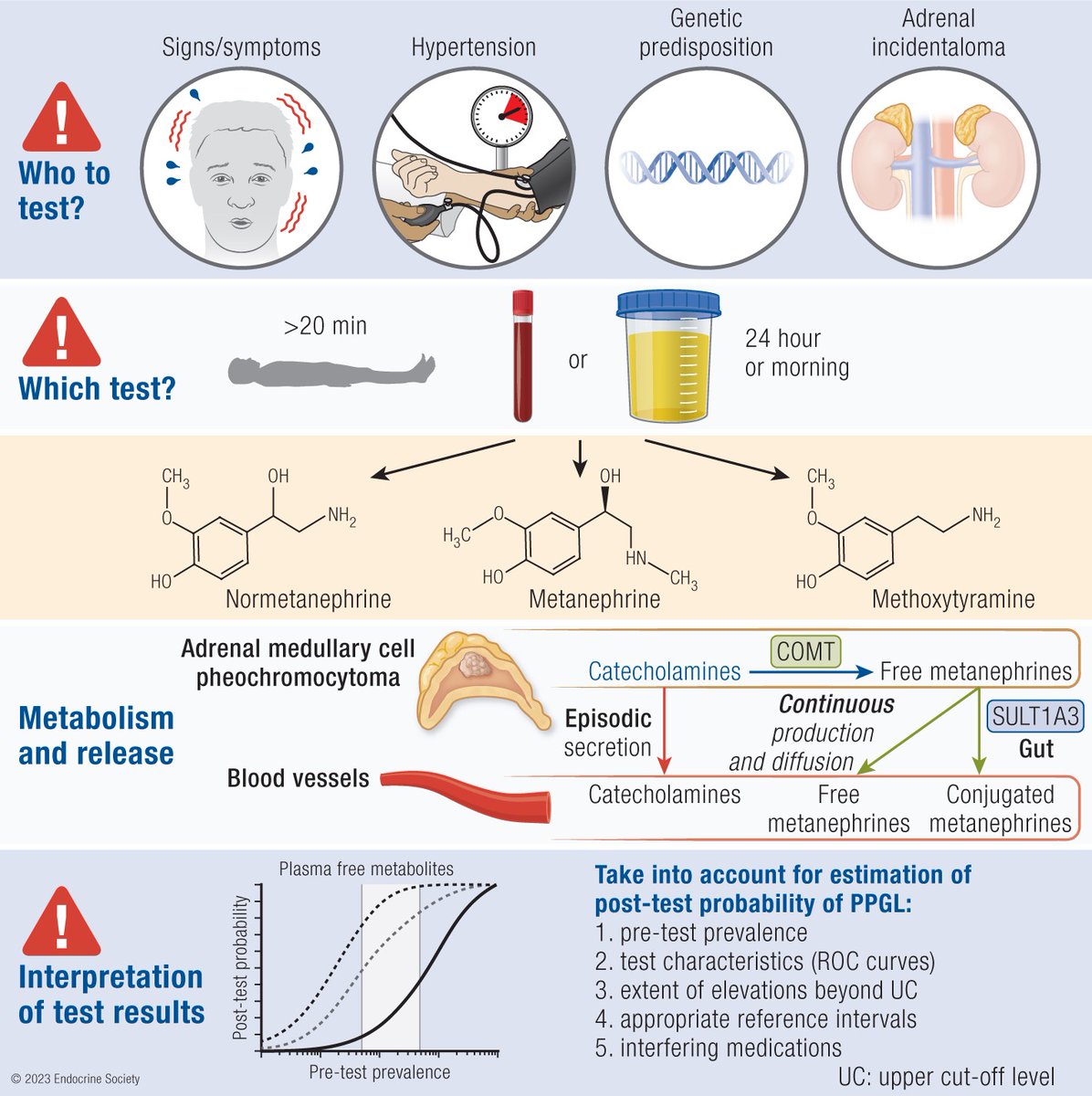 giorg_kyriakos's tweet photo. Biochemical Assessment of #Pheochromocytoma and #Paraganglioma
👉 https://t.co/EtQs9pIs9u
@EndoSocJournals @TheEndoSociety https://t.co/1xpKURbK1K