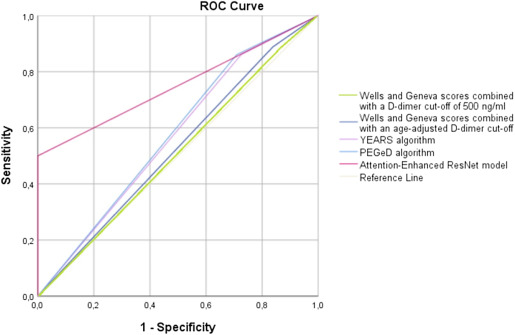 Our article "Artificial intelligence-based diagnosis of acute pulmonary embolism: Development of a machine learning model using 12-lead electrocardiogram" was just published, sciencedirect.com/science/articl… #MLKD #LUMLIS