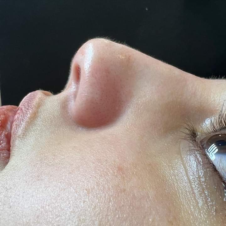 بحب جدا تكون علاقاتي محدوده بس كلها حب ومصداقيه وموده ومفيش خلافات ع حاجات تافهه ولا في ذرة كُره لبعض .. ديه اكتر حاجه بتريحني نفسيا حرفيا ♥️.