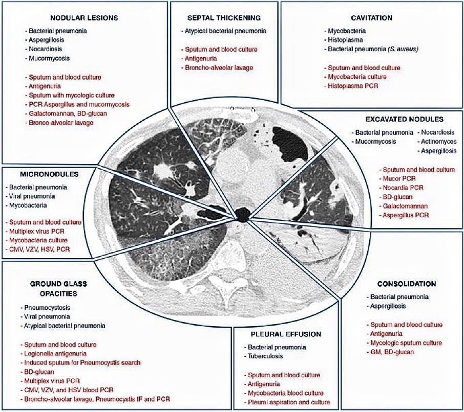 TheKoshurDoc's tweet photo. ▫️Chest 🩻 &amp; CT made easy
- Common signs and patterns

#MedEd #MedTwitter #radtwitter #ThreadEd
#ThreadGuy #ThreadDoc #TheThreadDoc
#ThreadTwitter @IhabFathiSulima https://t.co/oO0Jh8ZxuW