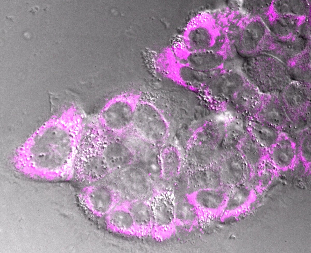 axenciaGAIN's tweet image. 🔍 No #DíaMundialdaSaúde destacamos o proxecto #RuCSC, liderado por José Luis Mascareñas @ciqususc  @UniversidadeUSC e apoiado polo Programa #Ignicia, que busca mellorar a vida das persoas que padecen #cancro. Coñece todos os detalles no blog ➡️ganadores.gal/RuCSC/O-poder-…