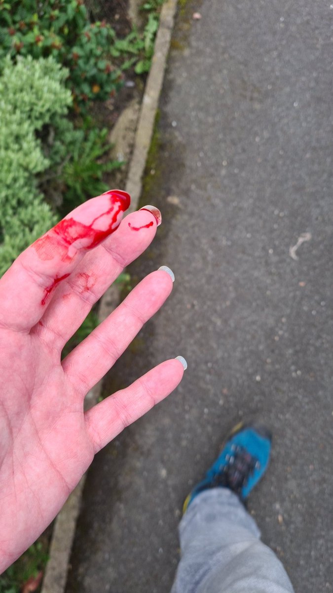 If your dog bites people. MUZZLE THEM. Don't let them interact with strangers.

I am in fucking pain rn and this was avoidable l: