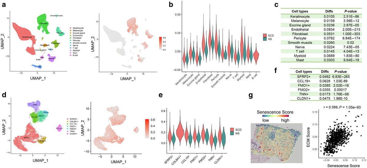 Eliza PS Tsou (@elizatsou) on Twitter photo We found that cellular senescence is elevated in #scleroderma skin! AND the senescence signature correlates significantly with the extracellular matrix score🧐〽️🤔 <a href="/theJIDJournal/">Journal of Investigative Dermatology</a> <a href="/UMIntMed/">U-M Department of Internal Medicine</a> <a href="/UMichResearch/">Michigan Research</a> <a href="/sclerodermaUM/">Dr. Dinesh Khanna</a> sciencedirect.com/science/articl… We found that cellular senescence is elevated in #scleroderma skin! AND the senescence signature correlates significantly with the extracellular matrix score🧐〽️🤔 <a href="/theJIDJournal/">Journal of Investigative Dermatology</a> <a href="/UMIntMed/">U-M Department of Internal Medicine</a> <a href="/UMichResearch/">Michigan Research</a> <a href="/sclerodermaUM/">Dr. Dinesh Khanna</a> sciencedirect.com/science/articl…