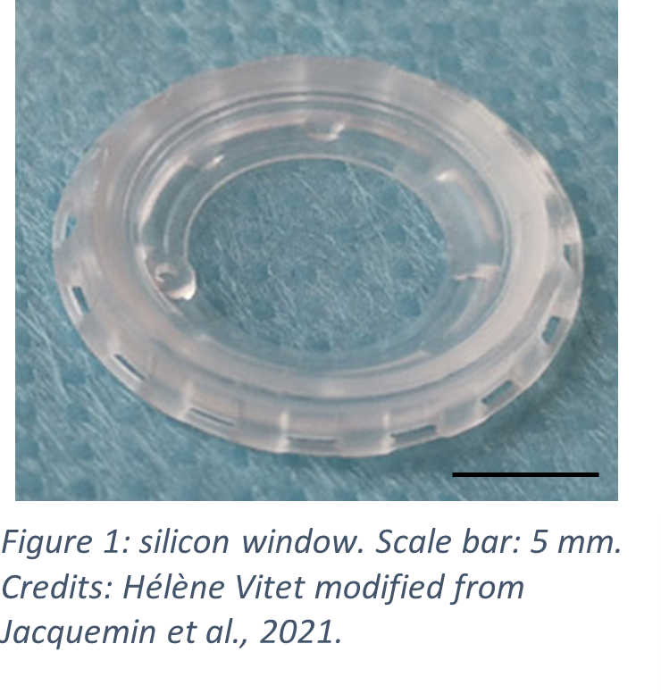 IdylleLabs's tweet photo. A silicon window for mouse intravital imaging
👏 Published by Guillaume Jacquemin and al. and shared by Helene Vitet on the Idylle blog🙏
https://t.co/E9TRZKSe6r
#IntravitalMicroscopy #Polydimethylsiloxane #PDMS #InternalTissues #SutureFree #TissueGrowth #DynamicBodyLocations https://t.co/kbRNgwwMGZ