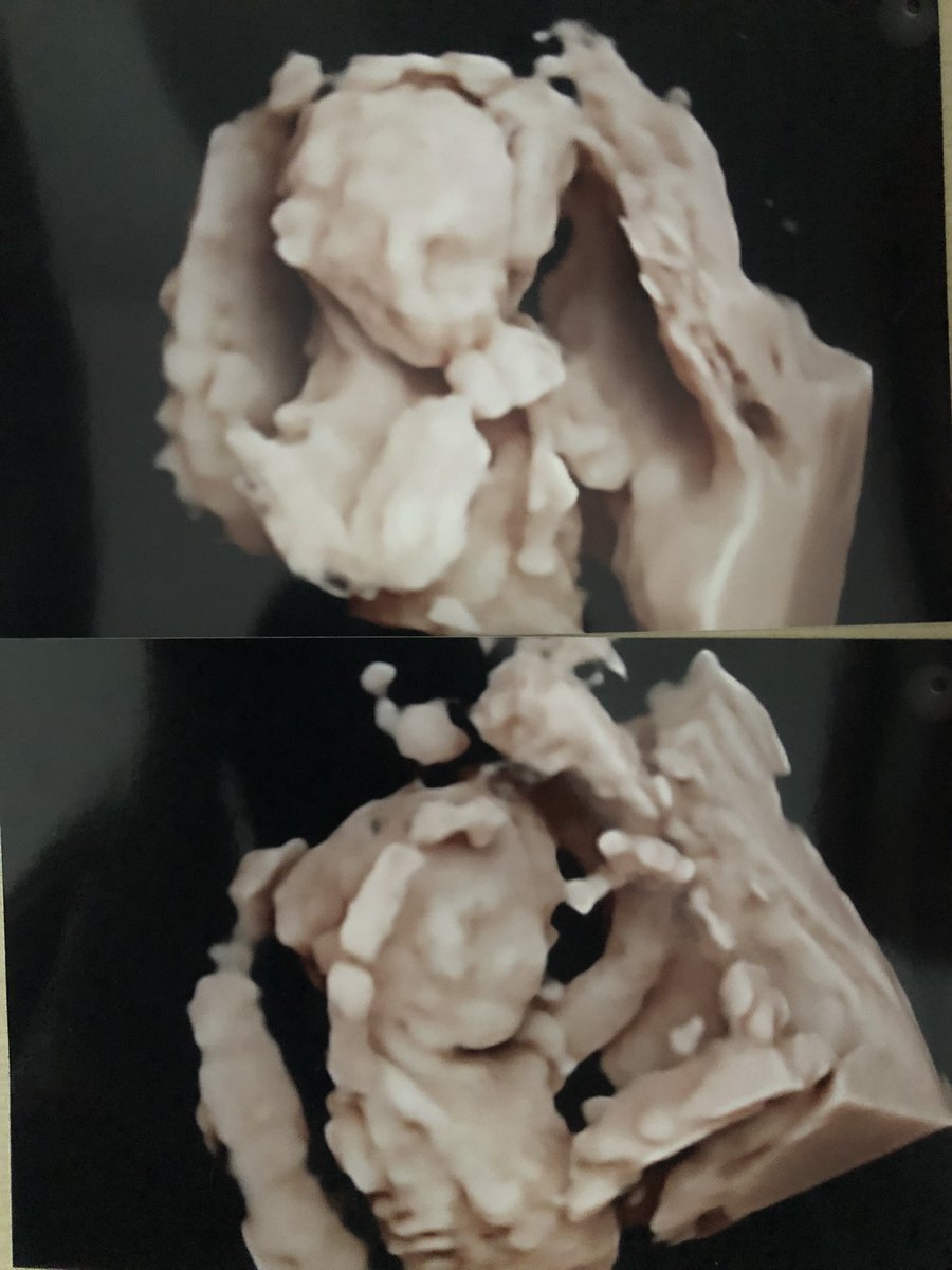 Voy a ser el papa de esta cosita🥹🤍