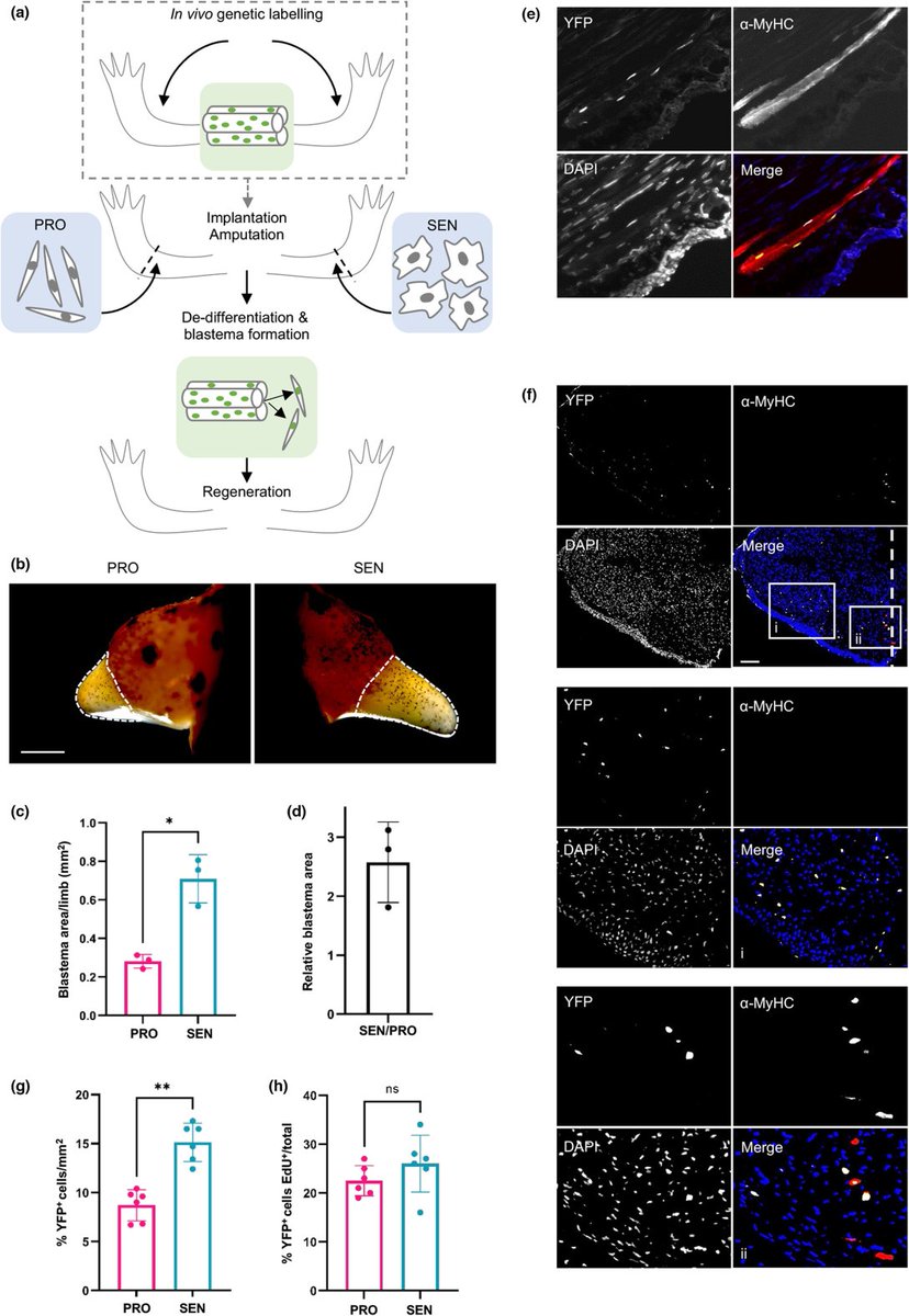 agingdoc1's tweet photo. Senescent cells enhance newt limb regeneration by promoting muscle dedifferentiation

@HannahWalters30, Konstantin Troyanovskyi, Alwin Graf. @MaxYunLab 

https://t.co/xz6rj0IErS

@Aging_Cell https://t.co/DPJWEzWUQa