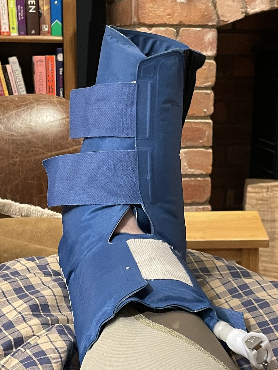 DrLindaDykes's tweet image. Update: Ottowa-rules-negative if I’m generous about the lateral malleolar tip. Have done about 6000 steps since doing animal care chores. Now extracted from welly, and Cryo-Cuff on which feels amazing. #clumsy #proprioceptionfail #physicianhealthyself