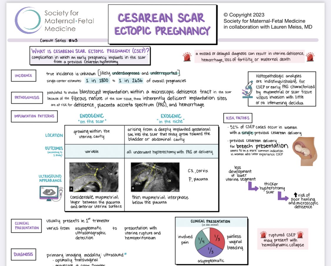 Have you checked out the new visual summary by <a href="/MySMFM/">SMFM</a> on cesarean scar ectopic pregnancy yet? 

You can find it here:

tinyurl.com/2fu56waf