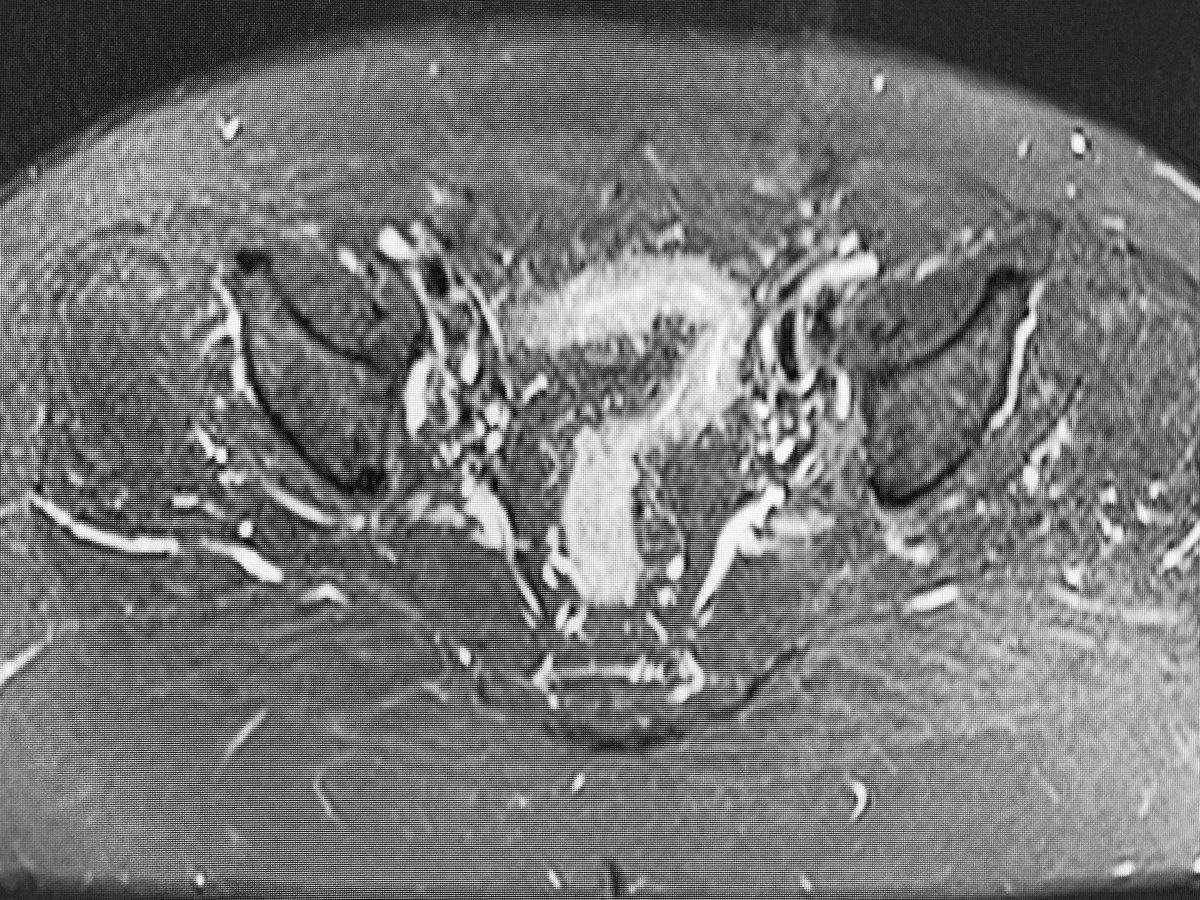 How an MSK radiologist sees the pelvic organs